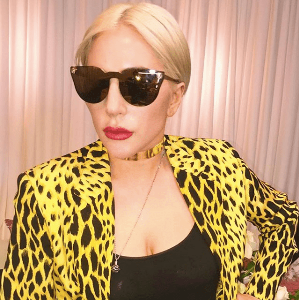 Lady Gaga yang energetik adalah orang dengan autoimun Lupus Photo IG: @ladygaga